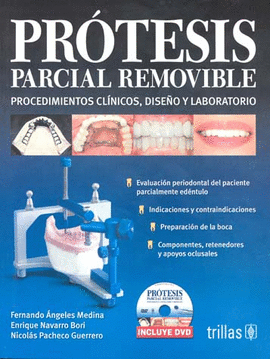 PROTESIS PARCIAL REMOVIBLE C/DVD. PROCEDIMIENTOS CLINICOS, DISEÑO Y ...